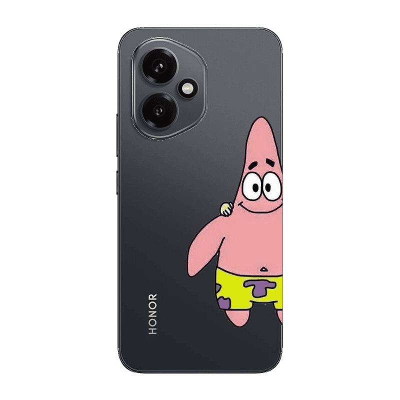 Honor Magic 400 Spong 1 Transparent Silicone TPU Θήκη